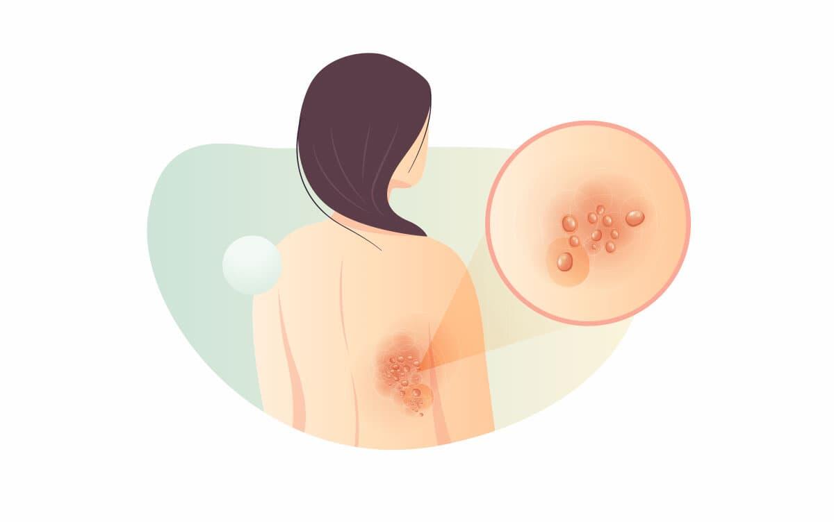 研究イメージ画像